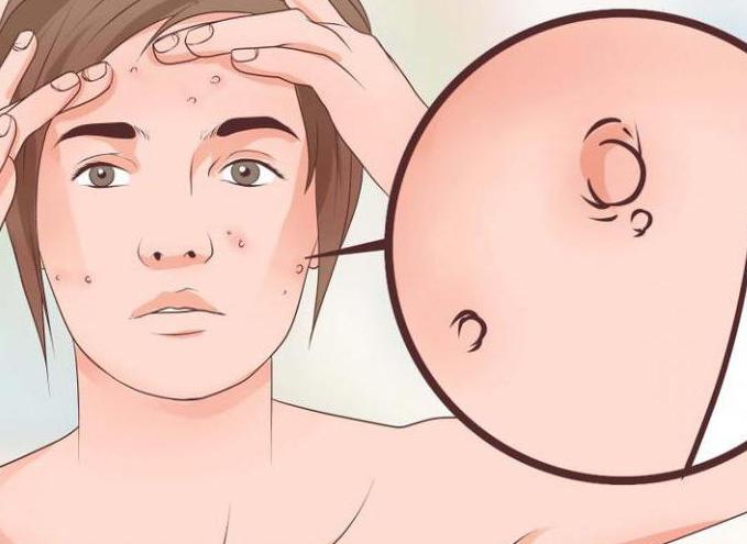 глево инструкция отзывы