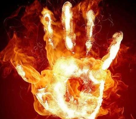 что делать при ожоге огнем на руке