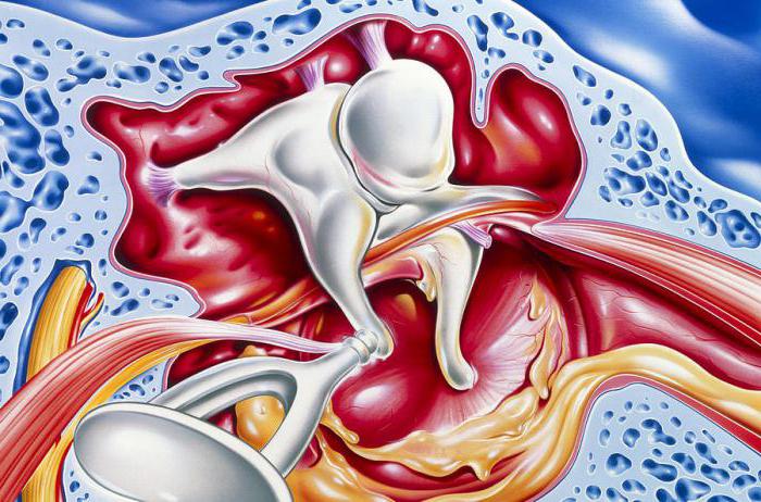 лечение отита у взрослых антибиотиками