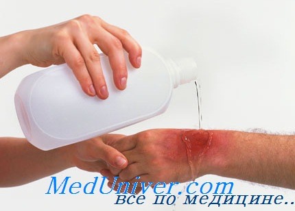 первая помощь при ожогах