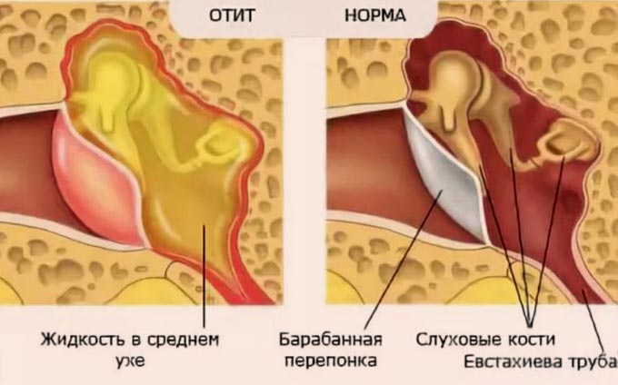 первое фото