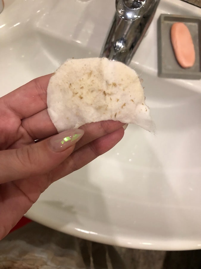 Лазерная шлифовка ожога 3 степени