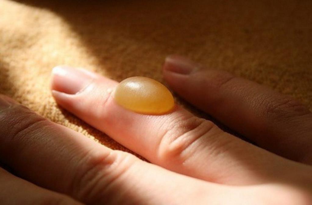 глубокий ожог