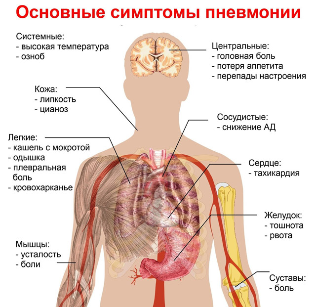 Начальная фаза интерстициальной пневмонии проявляется