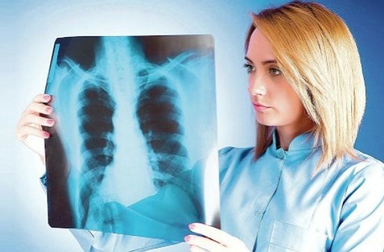 Лобулярная казеозная пневмония