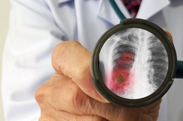 Витамины для восстановления ребенка после пневмонии