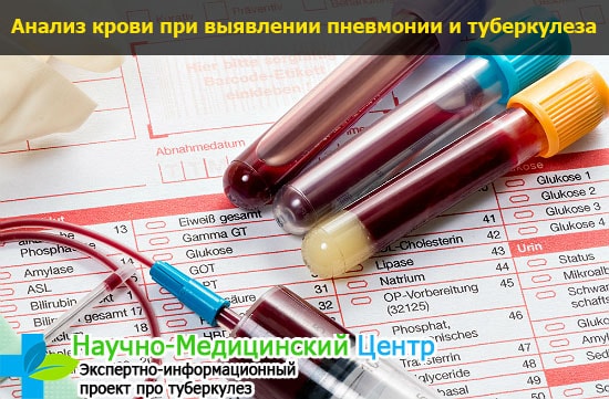 Пневмония и туберкулез легких противопоказания