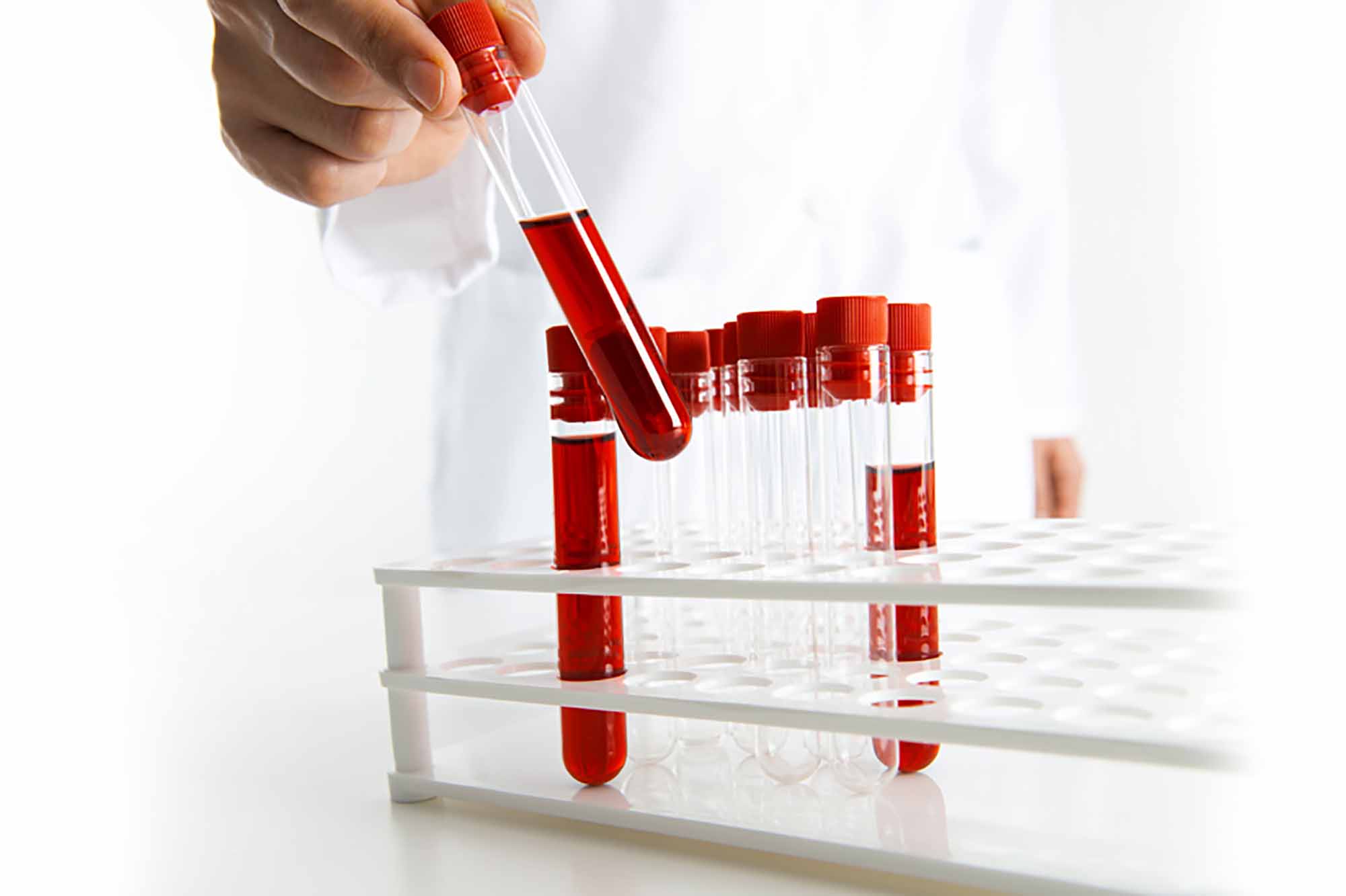 Как делать анализ крови