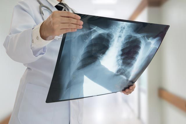 Витамины для восстановления ребенка после пневмонии