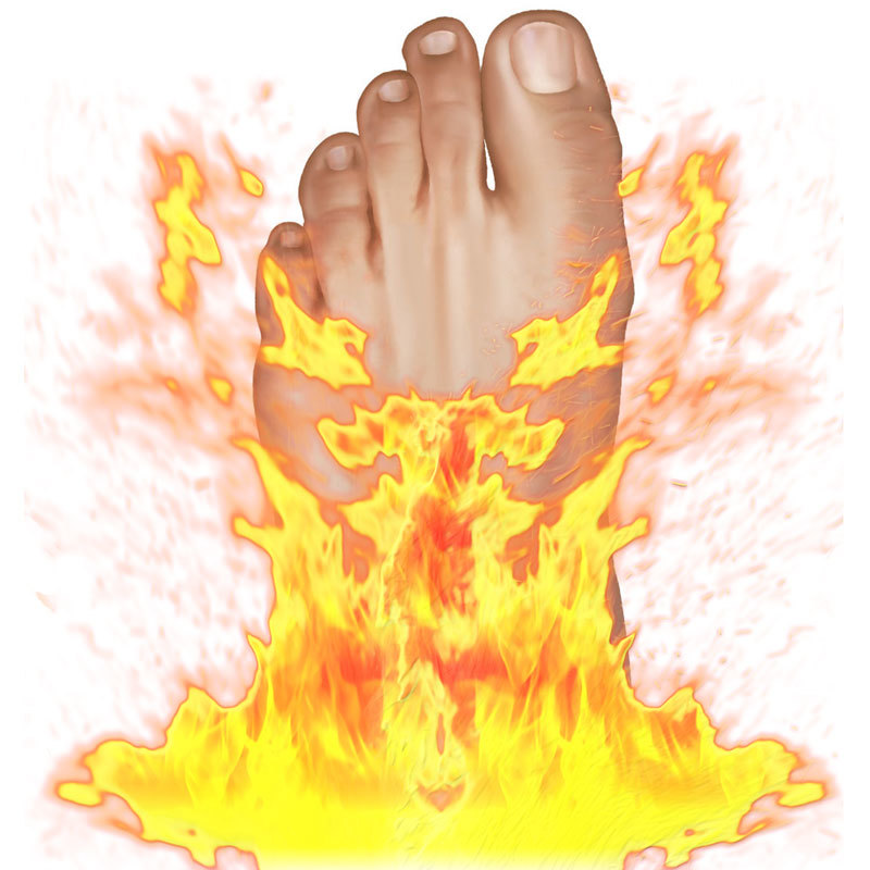 Почему «горят» пятки: Психосоматика подагры и жжения в ступнях Почему «горят» пятки: Психосоматика подагры и жжения в ступнях