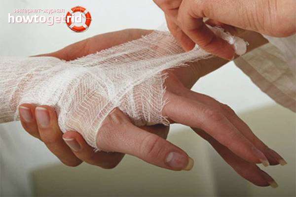 Как избавиться от боли после химического ожога