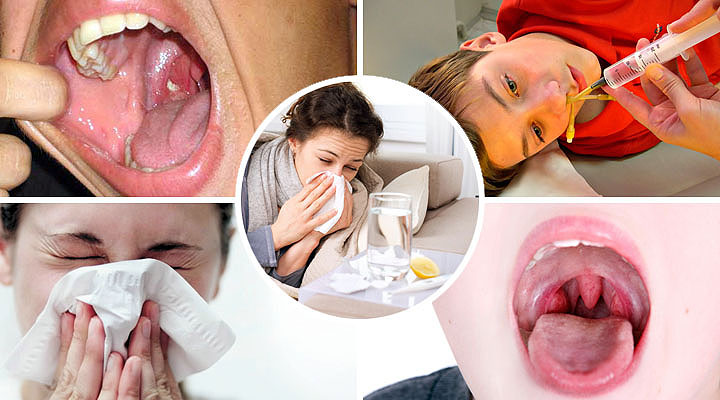 Патология развивается в качестве осложнения следующих заболеваний Способы проникновения болезни