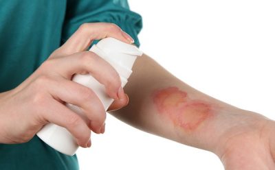 Что делать если содрали волдырь от ожога