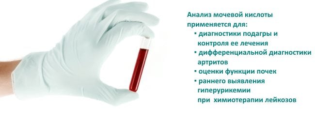 Подагра ног и жжение стопы