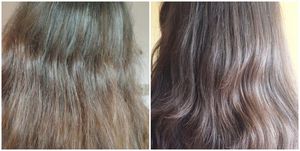 Чем лечат кожу головы после химического ожога