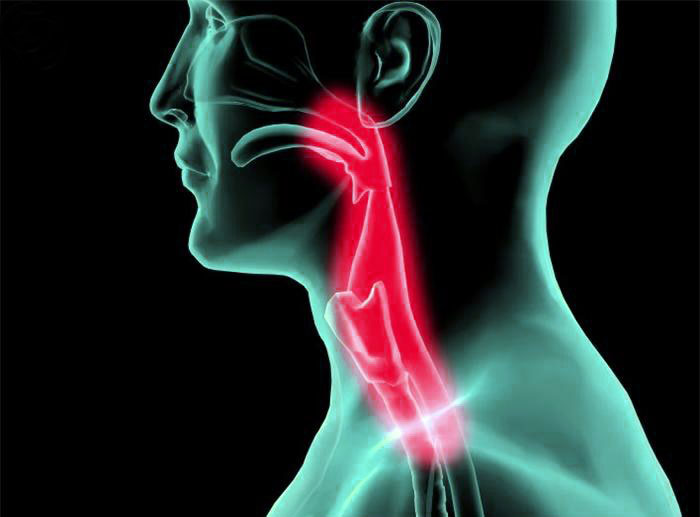 Степень поражение слизистых тканей горла при ожоге