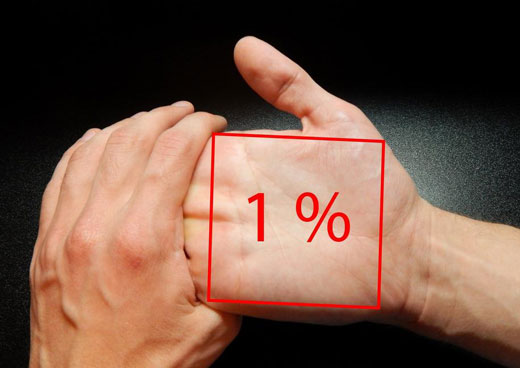 Площадь ожога