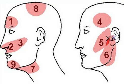 Почему болят виски головы