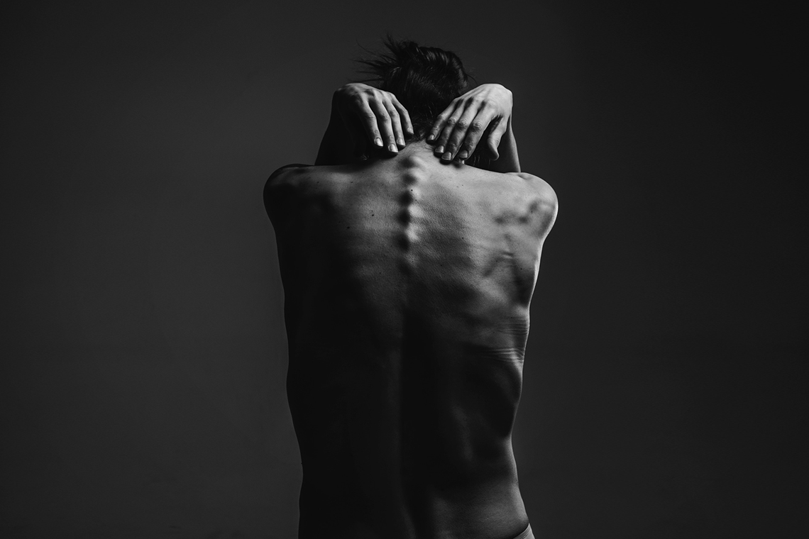 Давил прыщ болит голова