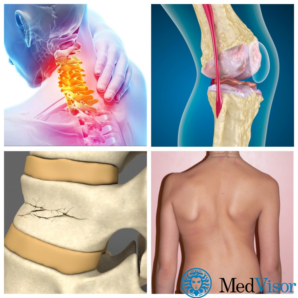 Другие проблемы со спиной Обострение болей в спине весной