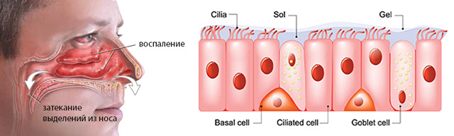 Если болит голова и сопли с кровью