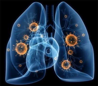 слева где спина болит