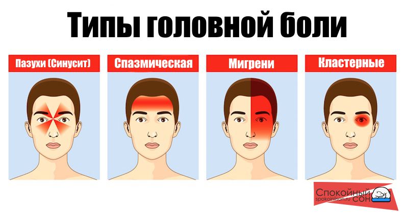 Особенность головной боли заключается в том, что возможно причина возникновения симптома кроется вовсе не в недосыпе. При систематических появлениях цефалгии что делать подскажет врач после проведения комплексной диагностики и постановки диагноза. В общем случае головную боль разделают на несколько категорий в зависимости от ее характера
