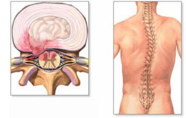 почему болит спина в пояснице когда сидишь