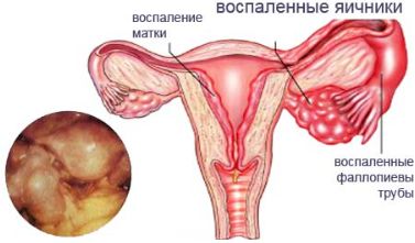 слева где спина болит