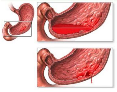 слева где спина болит