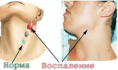 Болит спина пах температура
