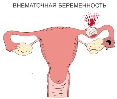 16 день цикла болит спина