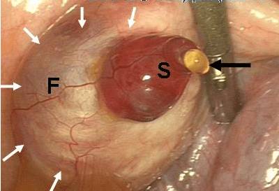 16 день цикла болит спина