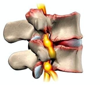 почему болит спина в пояснице когда сидишь