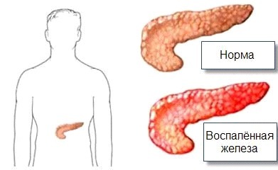 слева где спина болит