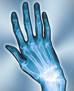 Болят кисти рук и спина